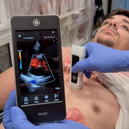 MDA brings ultrasound to ambulances and helicopters.
